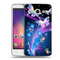 Дизайнерский пластиковый чехол для LG L60 Бабочки
