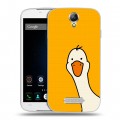 Дизайнерский силиконовый чехол для Doogee X6 Утка