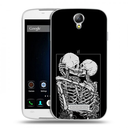 Дизайнерский силиконовый чехол для Doogee X6 Поцелуй скелетов
