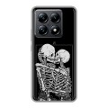 Дизайнерский силиконовый чехол для Xiaomi 14T Pro Поцелуй скелетов