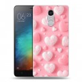 Дизайнерский пластиковый чехол для Xiaomi RedMi Pro Сердечки