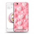 Дизайнерский пластиковый чехол для Xiaomi RedMi 5A Сердечки