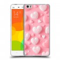 Дизайнерский пластиковый чехол для Xiaomi Mi Note Сердечки