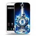 Дизайнерский силиконовый чехол для Doogee X6 Chelsea Челси