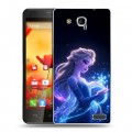 Дизайнерский пластиковый чехол для MTS 978 Холодное сердце Frozen