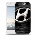 Дизайнерский пластиковый чехол для HTC One A9 Hyundai