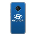 Дизайнерский силиконовый чехол для Vivo V17 Hyundai